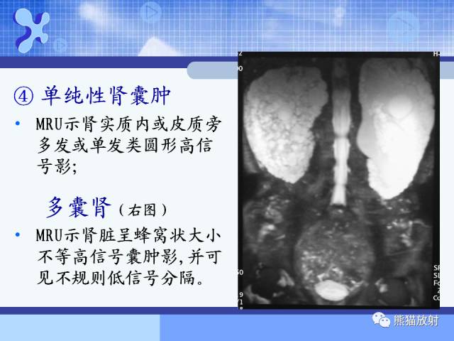 【PPT】MRU技术及临床应用 【PPT】MRU技术及临床应用