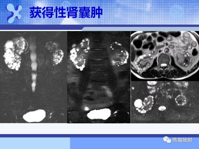 【PPT】MRU技术及临床应用 【PPT】MRU技术及临床应用