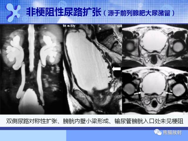 【PPT】MRU技术及临床应用 【PPT】MRU技术及临床应用