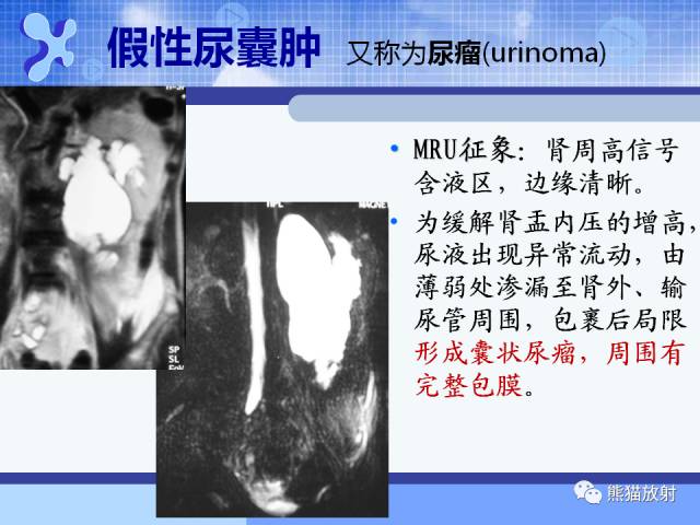 【PPT】MRU技术及临床应用 【PPT】MRU技术及临床应用