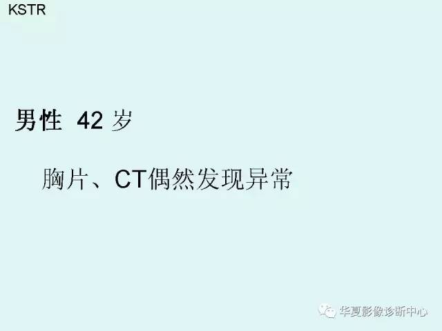 【病例】Poland综合征1例X线CT影像表现