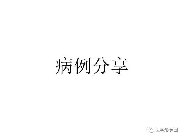 【病例】大脑镰旁占位—间变性星形细胞瘤1例MR