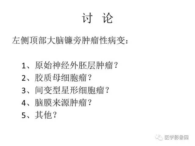 【病例】大脑镰旁占位—间变性星形细胞瘤1例MR