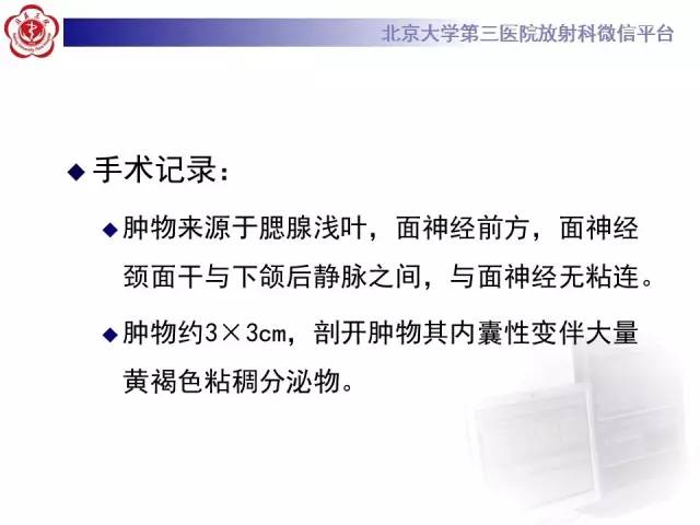 【病例】腮腺腺淋巴瘤1例CT及MR影像诊断