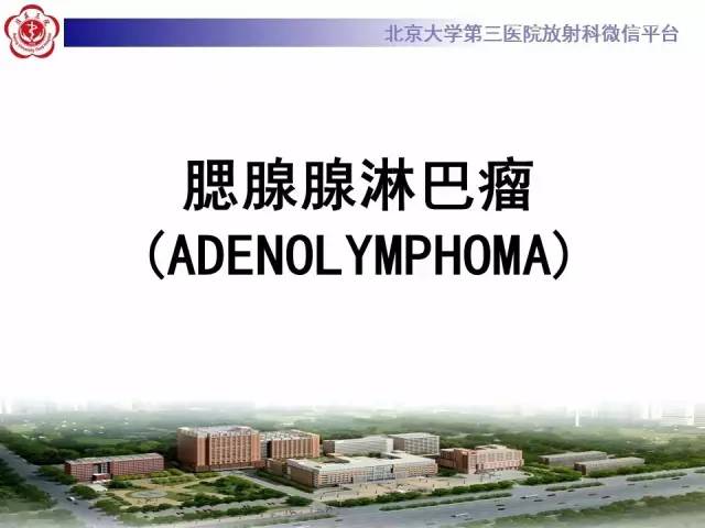 【病例】腮腺腺淋巴瘤1例CT及MR影像诊断