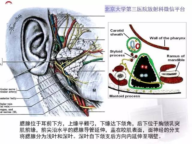 【病例】腮腺腺淋巴瘤1例CT及MR影像诊断