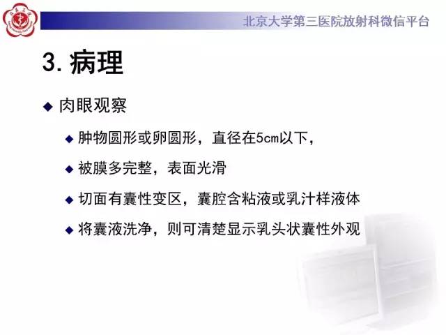 【病例】腮腺腺淋巴瘤1例CT及MR影像诊断