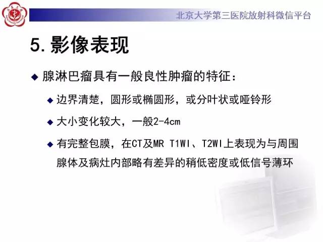 【病例】腮腺腺淋巴瘤1例CT及MR影像诊断