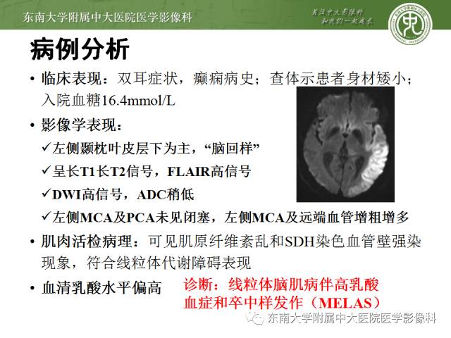 【病例】线粒体脑肌病1例MR影像诊断