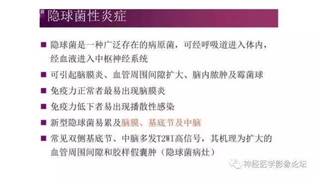 【病例】脑结核1例MR影像诊断