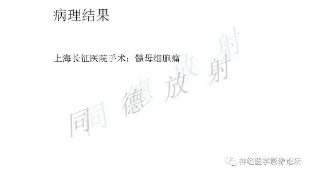 【病例】小脑半球髓母细胞瘤1例MR