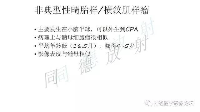 【病例】小脑半球髓母细胞瘤1例MR