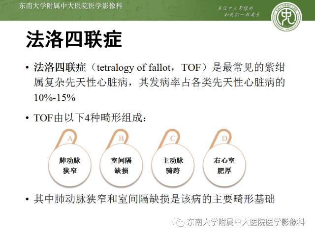 【病例】先心病法洛氏四联症1例CT三维重建