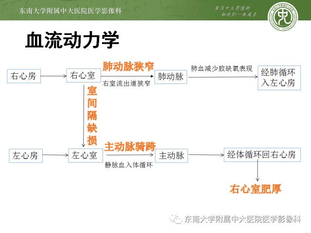 【病例】先心病法洛氏四联症1例CT三维重建