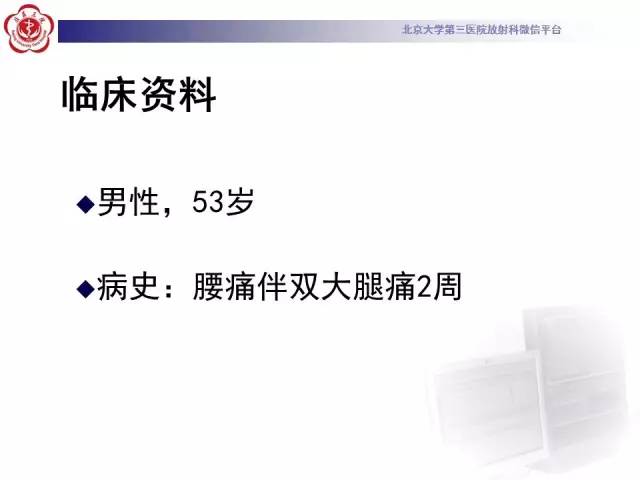 【病例】椎管内粘液乳头型室管膜瘤1例CT及MR