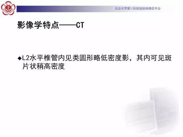 【病例】椎管内粘液乳头型室管膜瘤1例CT及MR