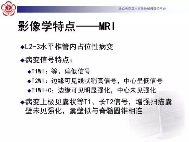 【病例】椎管内粘液乳头型室管膜瘤1例CT及MR