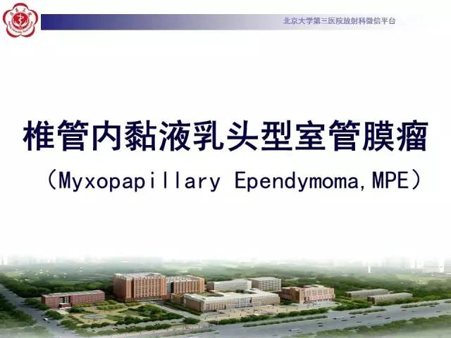 【病例】椎管内粘液乳头型室管膜瘤1例CT及MR