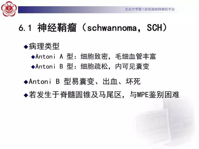 【病例】椎管内粘液乳头型室管膜瘤1例CT及MR