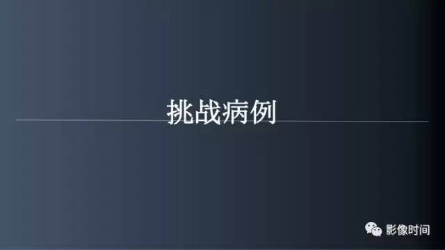 【病例】胸腰椎变异1例影像诊断分析