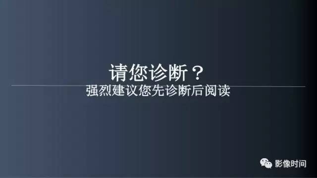 【病例】胸腰椎变异1例影像诊断分析