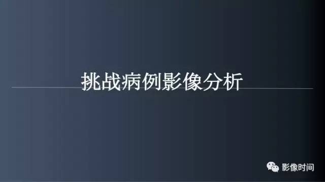 【病例】胸腰椎变异1例影像诊断分析