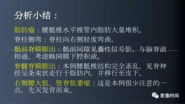 【病例】胸腰椎变异1例影像诊断分析
