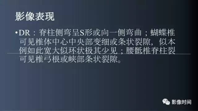 【病例】胸腰椎变异1例影像诊断分析