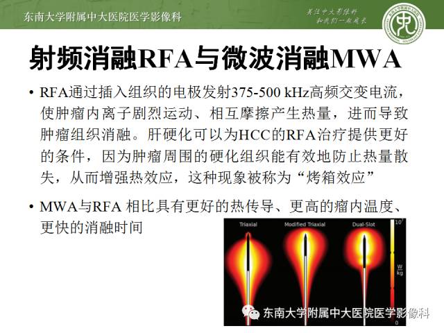 【病例】射频消融灶并发症—脓肿形成1例CT影像表现 【病例】射频消融灶并发症—脓肿形成1例CT影像表现