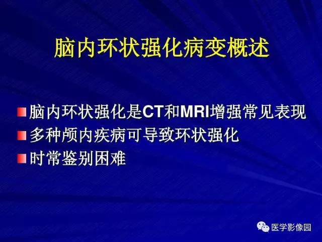 【PPT】颅内环状强化病变的影像学诊断及鉴别