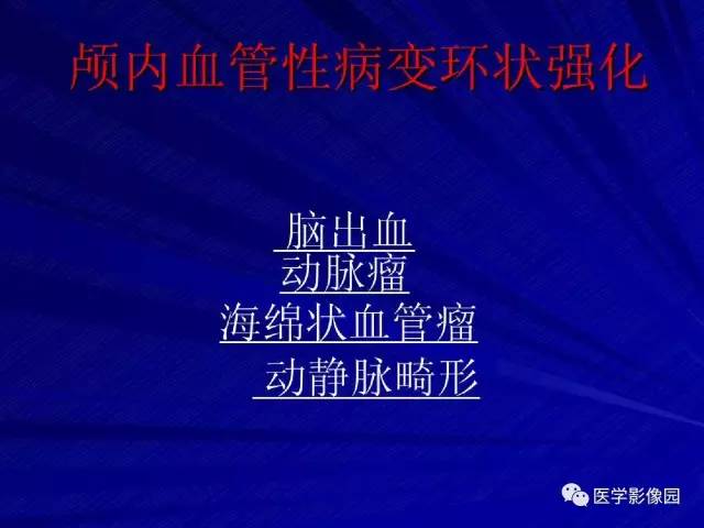 【PPT】颅内环状强化病变的影像学诊断及鉴别