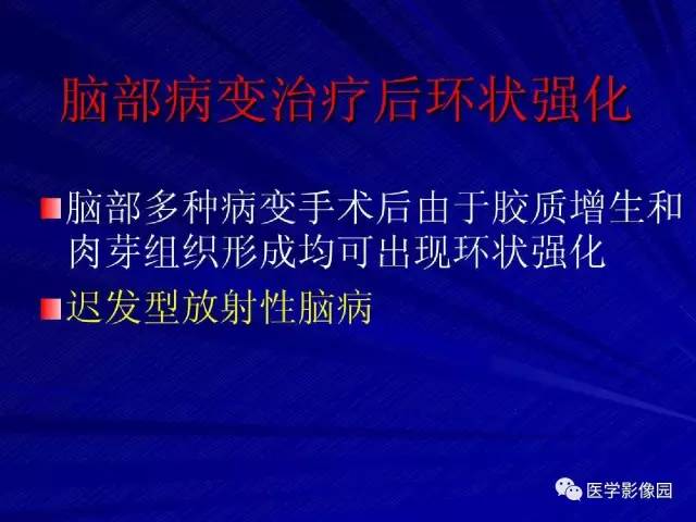 【PPT】颅内环状强化病变的影像学诊断及鉴别