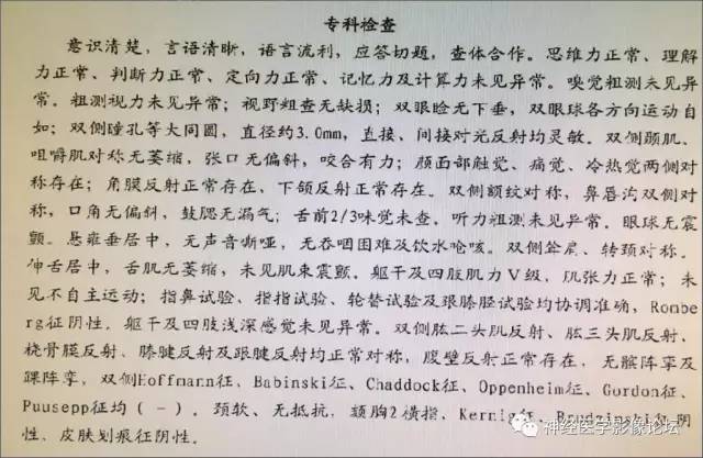 【病例】左侧脑室低级别星形细胞瘤1例MR影像表现