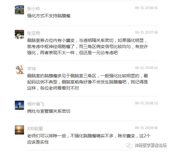 【病例】左侧脑室低级别星形细胞瘤1例MR影像表现