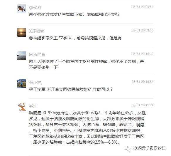 【病例】左侧脑室低级别星形细胞瘤1例MR影像表现