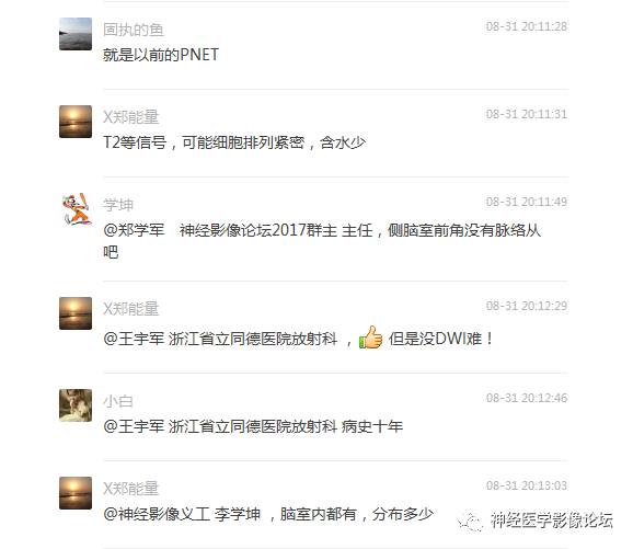 【病例】左侧脑室低级别星形细胞瘤1例MR影像表现