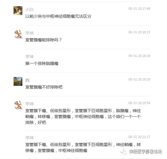【病例】左侧脑室低级别星形细胞瘤1例MR影像表现