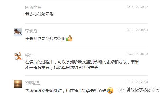 【病例】左侧脑室低级别星形细胞瘤1例MR影像表现