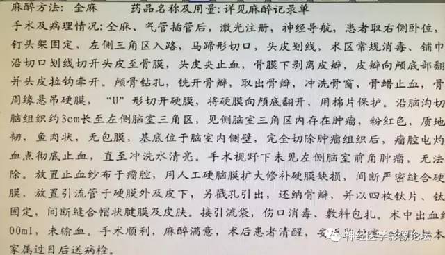 【病例】左侧脑室低级别星形细胞瘤1例MR影像表现
