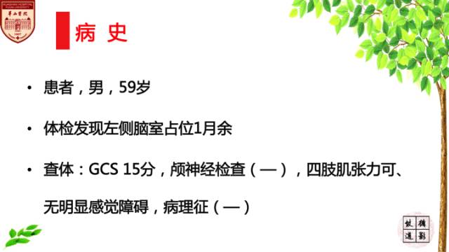 【病例】室管膜下瘤1例MR影像表现