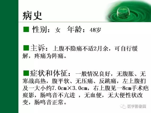 【病例】十二指肠神经内分泌肿瘤1例CT影像表现
