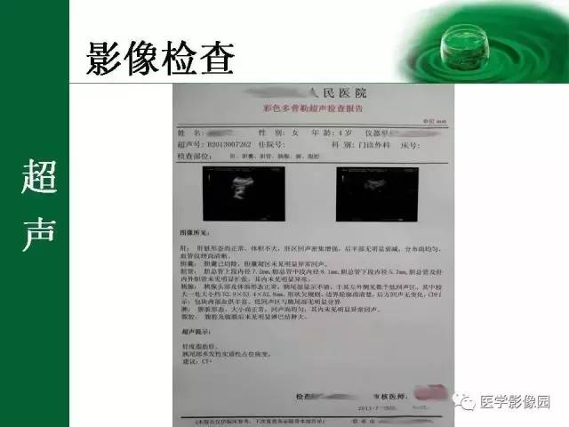 【病例】十二指肠神经内分泌肿瘤1例CT影像表现 【病例】十二指肠神经内分泌肿瘤1例CT影像表现