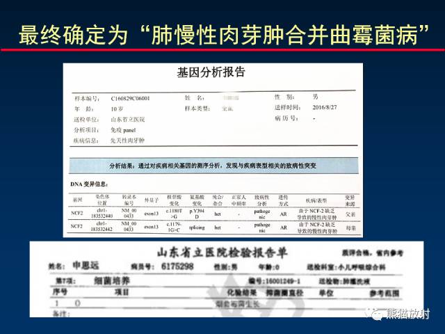 【PPT】小儿肺曲霉菌病相关CT表现分析