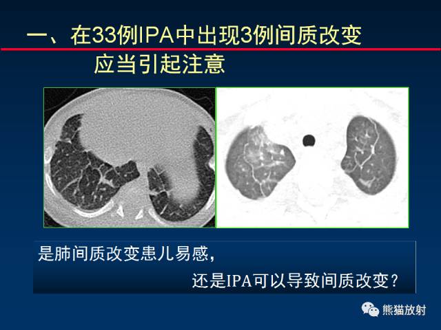 【PPT】小儿肺曲霉菌病相关CT表现分析