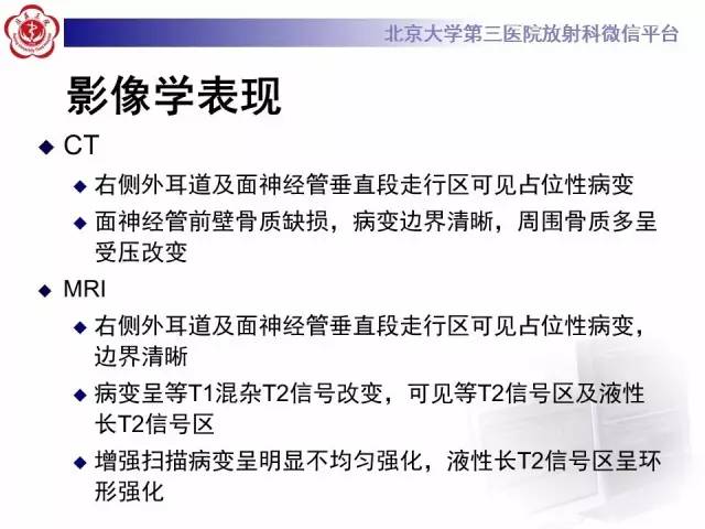 【病例】面神经鞘瘤1例CT及MR