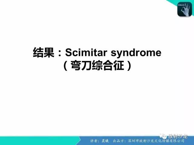【病例】弯刀综合征1例CT影像表现