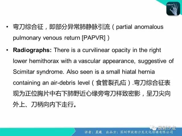 【病例】弯刀综合征1例CT影像表现
