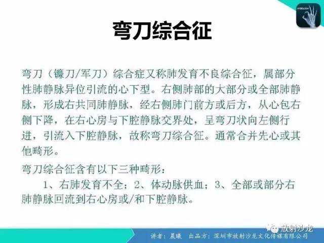 【病例】弯刀综合征1例CT影像表现