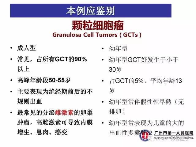 【病例】卵巢子宫内膜间质肉瘤1例MR
