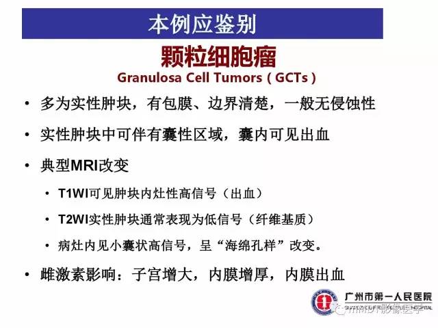 【病例】卵巢子宫内膜间质肉瘤1例MR